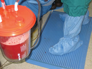 The Suction Mat shown with canister